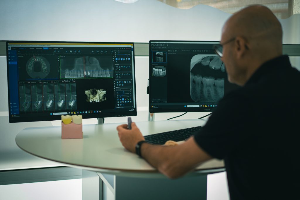 Installation scanner 3D pour implantologie cabinet dentaire Mondonville Dr Brunato